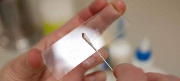 Kratzen nach Wurmeiern